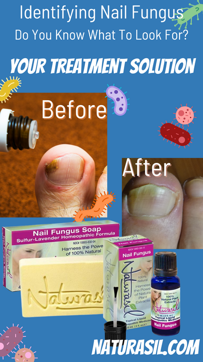 Nail Fungus Treatment Bundle