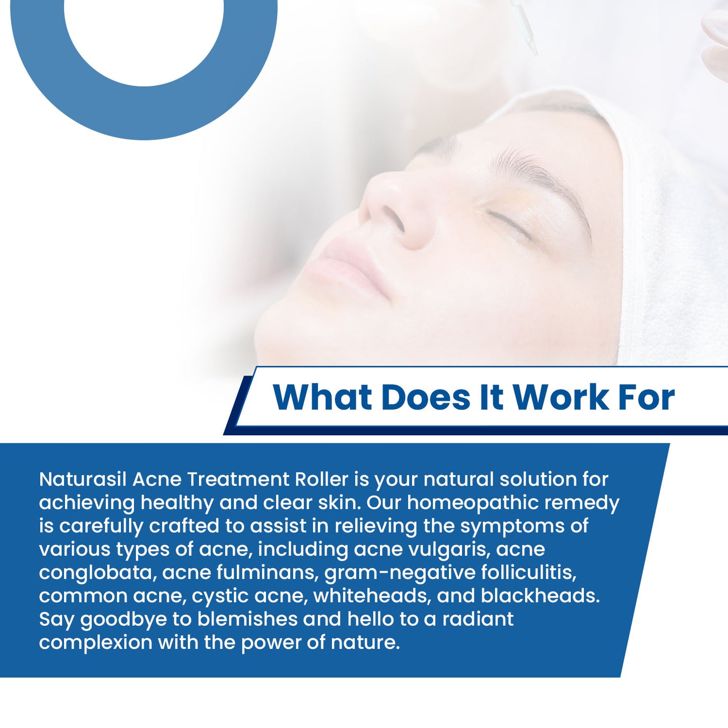 Acne Treatment 10 mL Roll-On