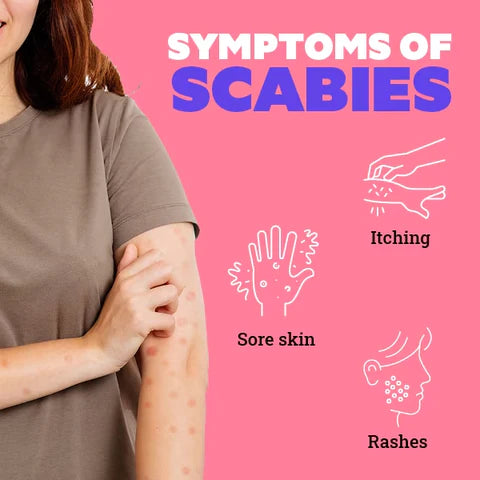 In-Depth Scabies Guide eBook *Free with Any Scabies Pack* ($9.99 value)