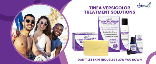 How Do You Get Rid Of Tinea Versicolor?