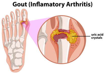Gout Pain and Inflammation Relief - 15 mL