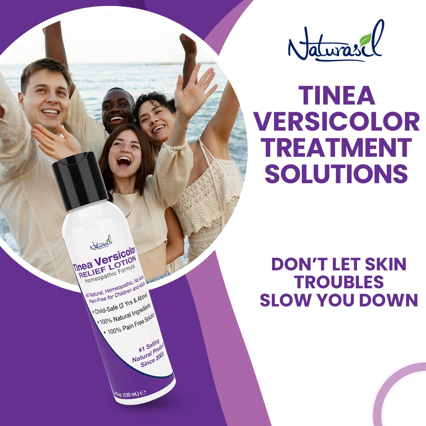 Tinea Versicolor 10% Sulfur Medicated Lotion | 4 oz