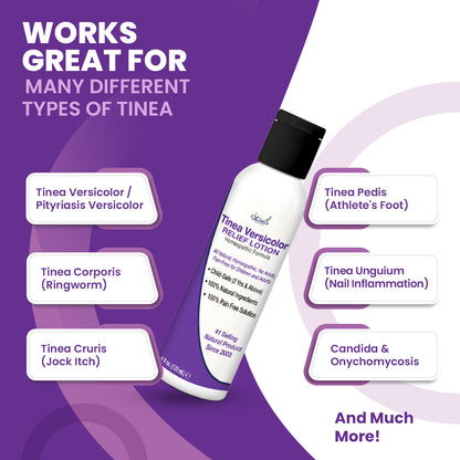 Tinea Versicolor 10% Loción medicada con azufre | 4 onzas