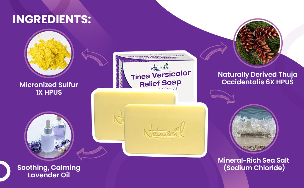 Tinea Versicolor Sulfur Medicated Soap | (2 Pack)