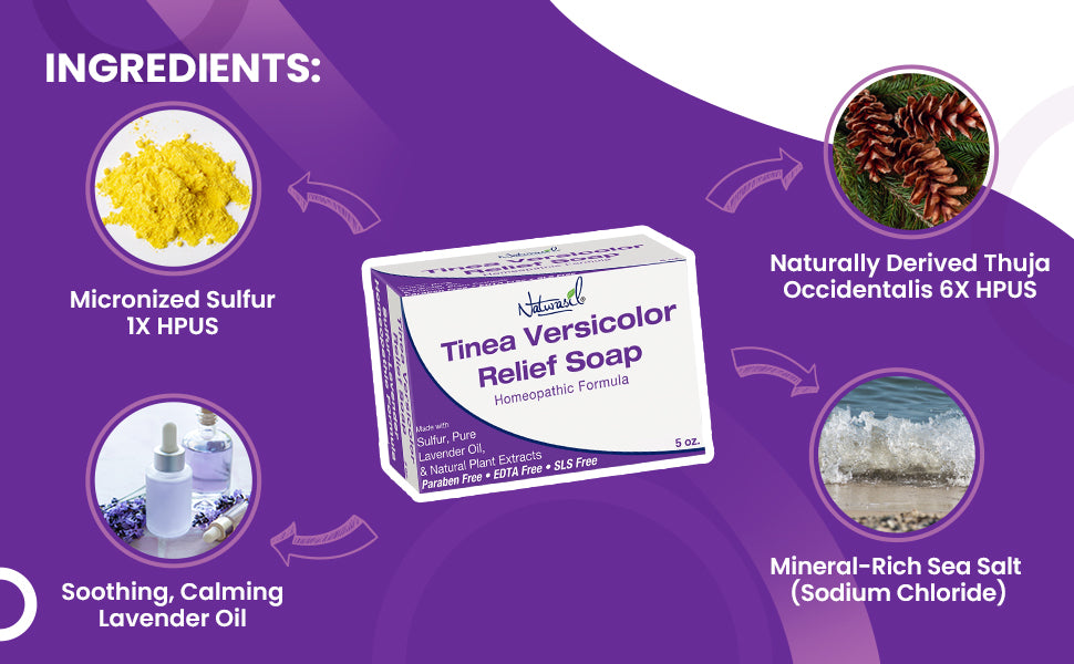 Tinea Versicolor Sulfur Medicated Soap | 5oz