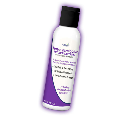 Tinea Versicolor Sulfur Medicated Lotion | 4 oz