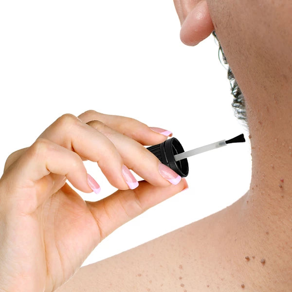 Skin Tags Remover | 15 mL