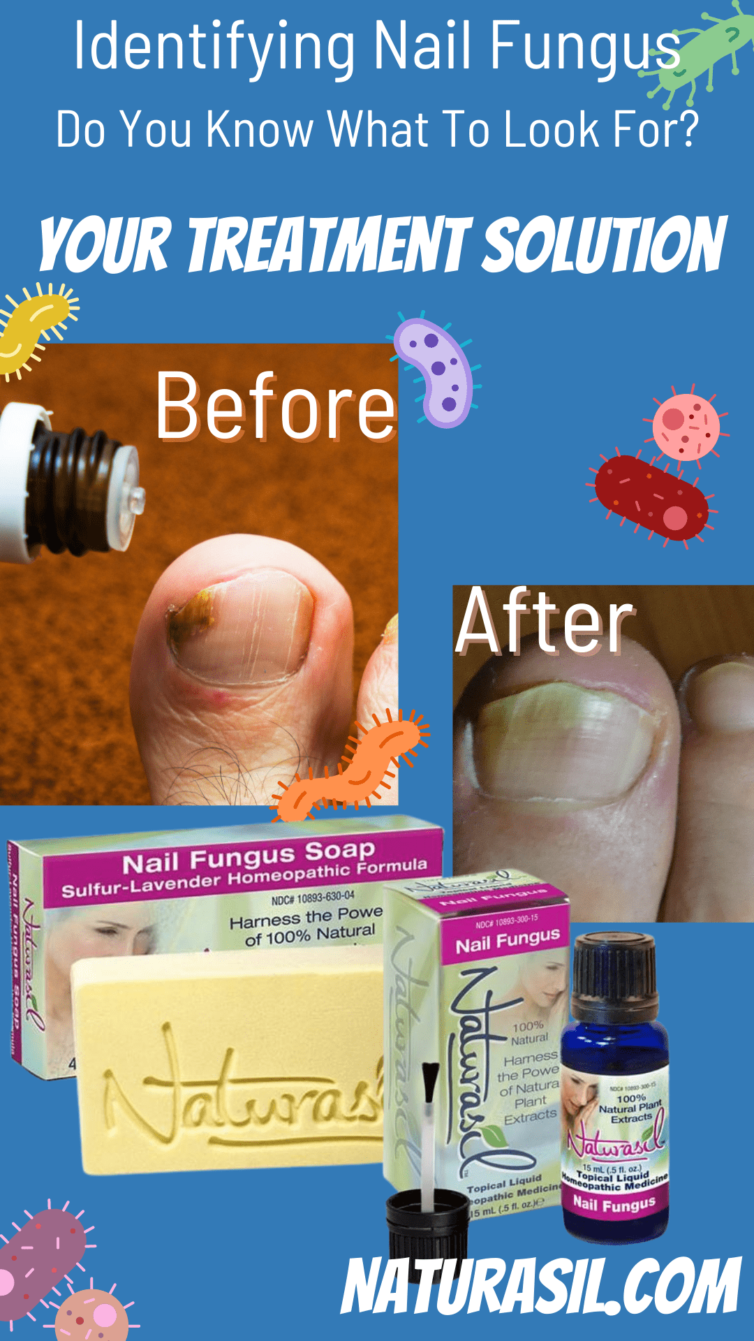 Nail Fungus Medicated 10% Sulfur Soap | 4 oz Bar - Naturasil
