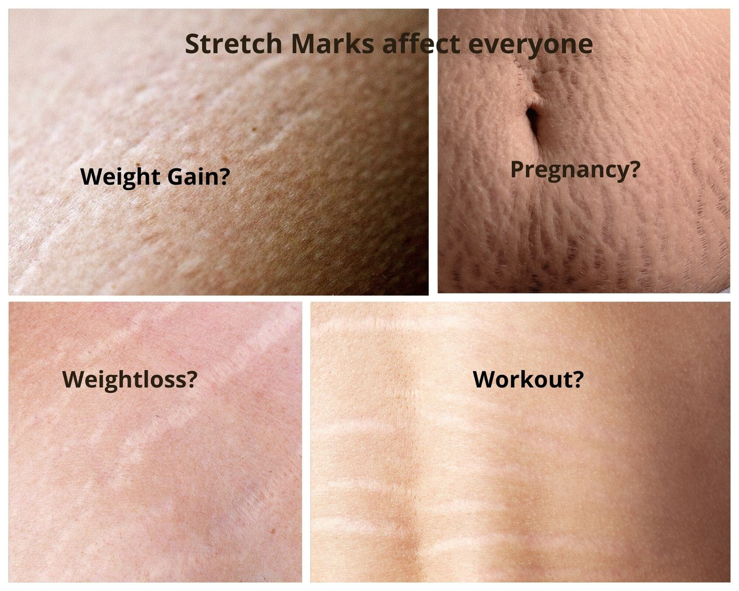 Stretch Mark Therapy | 15 mL Glass Bottle - Naturasil